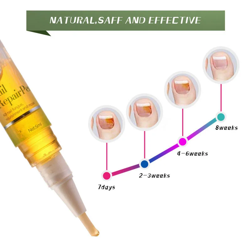 Hot 1pcs Nail Repair Anti Fungal Treatment Pen Onychomycosis Paronychia Infection Herbal Toe Finger Nutrition Health | Красота и