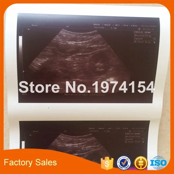 2X Rolls ultrasound UPP 110S 110mm*20m B-recorder UPP-110S thermal paper printer b-sheets A6 | Компьютеры и офис