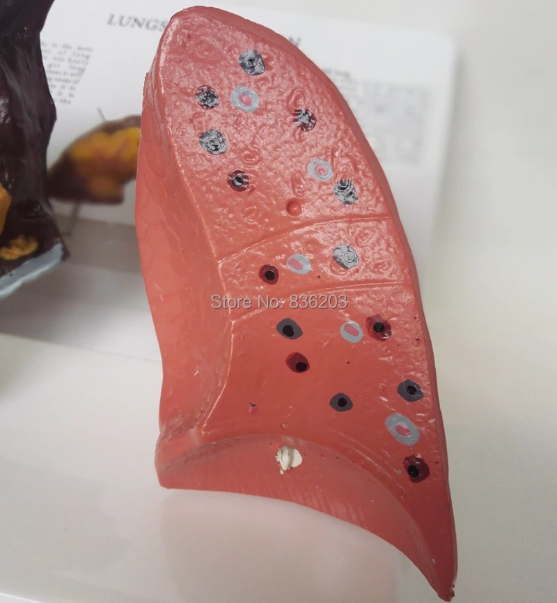 Медицинский шприц для обучения при раке легких|lungs model|human lung modelmodel lungs |