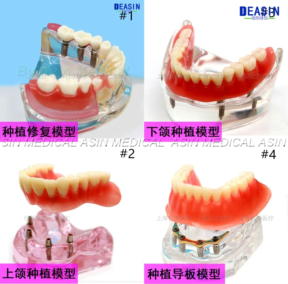 1 pc x high quality Resin Coverage dental implant model dentures Removable teeth for dentist study Deasin |