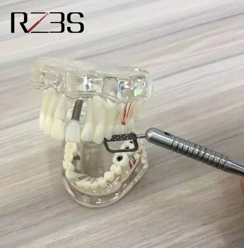 Стоматологический ортодонтический интерпроксимальный эмалевый редукционный