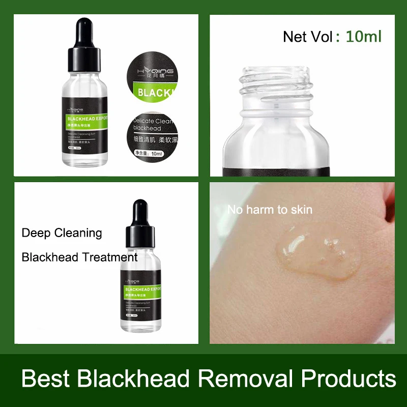 

10ml Natural Plant Extract Blackhead Remover Acne Treatment Face Essence Liquid Whitening Facial Serum Skin Care For Woman