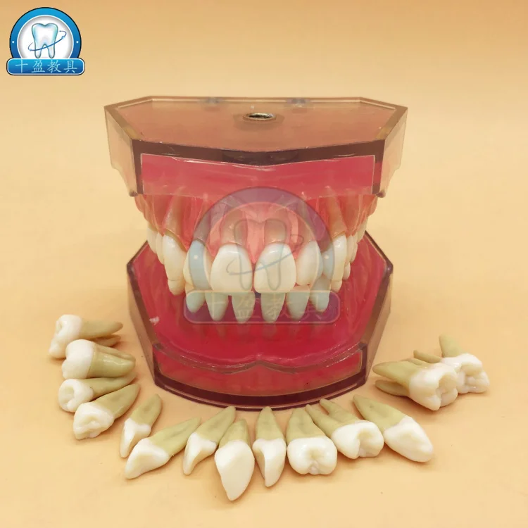 Dental Stomatology Teaching Model Extractable Teeth Demolition Simulation | Канцтовары для офиса и дома