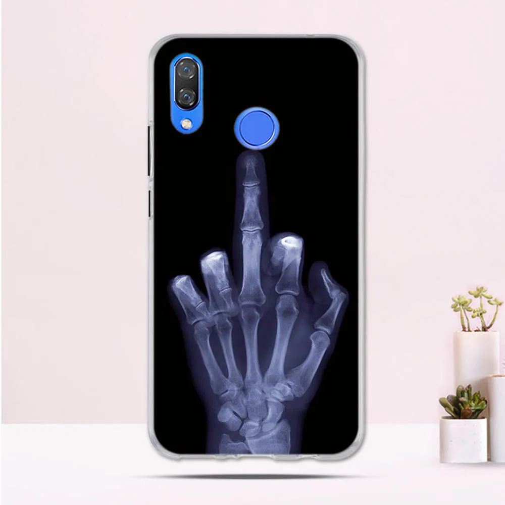 Чехол для Huawei Nova 3 мягкий силиконовый защитный чехол задней панели телефона Nova3