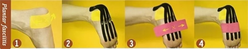 Кинезио тейпами(Kinesio tape) улучшает кровообращения и лимфотока 2074
