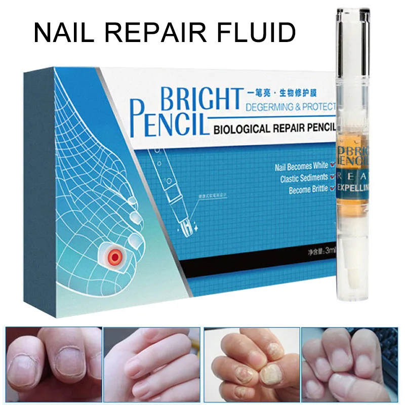 

3ml Nail Fungus Treatment Liquid Anti Fungal Toenail Fingernail Nails Repair Care 88