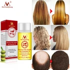 Эссенция для роста волос Meiyanqiong продукты для выпадения волос Эфирное Масло жидкое лечение для предотвращения выпадения волос продукты для ухода за волосами 20 мл