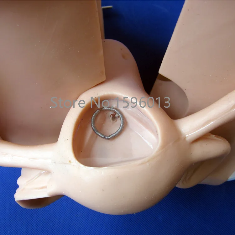 Усовершенствованная модель контрацепции противозачаточная помощь | Канцтовары