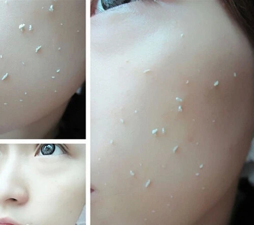 1 шт. Rolanjona Отшелушивающий гель для лица Уход за кожей скраб Средства ухода exfoliator