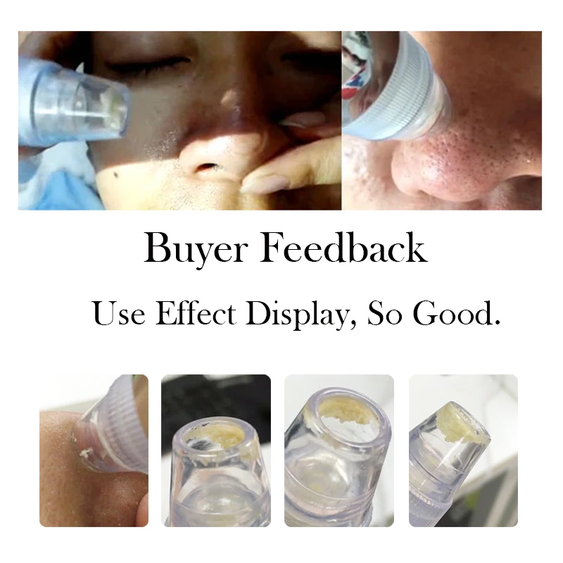 Уход за кожей пор вакуумное удаление черных точек прыщей акне Удаление вакуумный