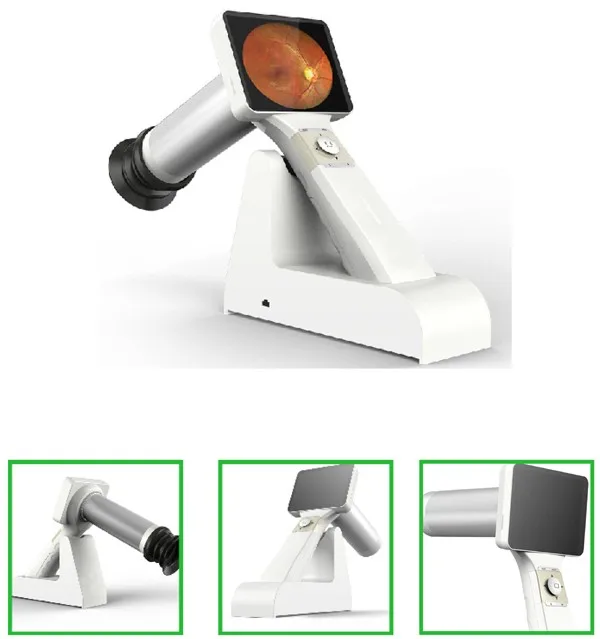 Портативный Non Mydriatic Fundus камера сетчатки с FDA для США