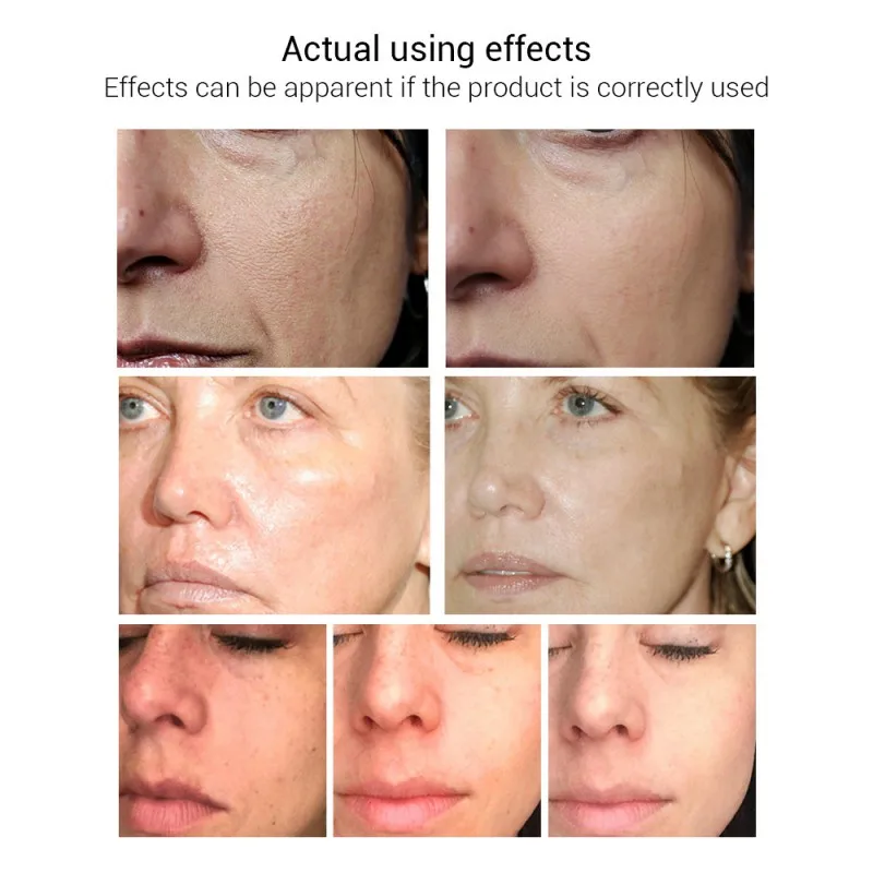 

Face Hyaluronic Acid Repair Essential Oil Skin Serum Face Cream Moisturizing Nourishing Acne Treatment Oil Control Whitening