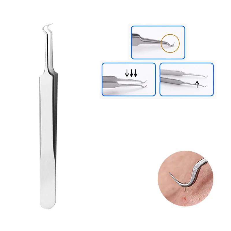 Полезная из нержавеющей стали прямой изгиб изогнутые Угри Акне клип пинцет прыщ