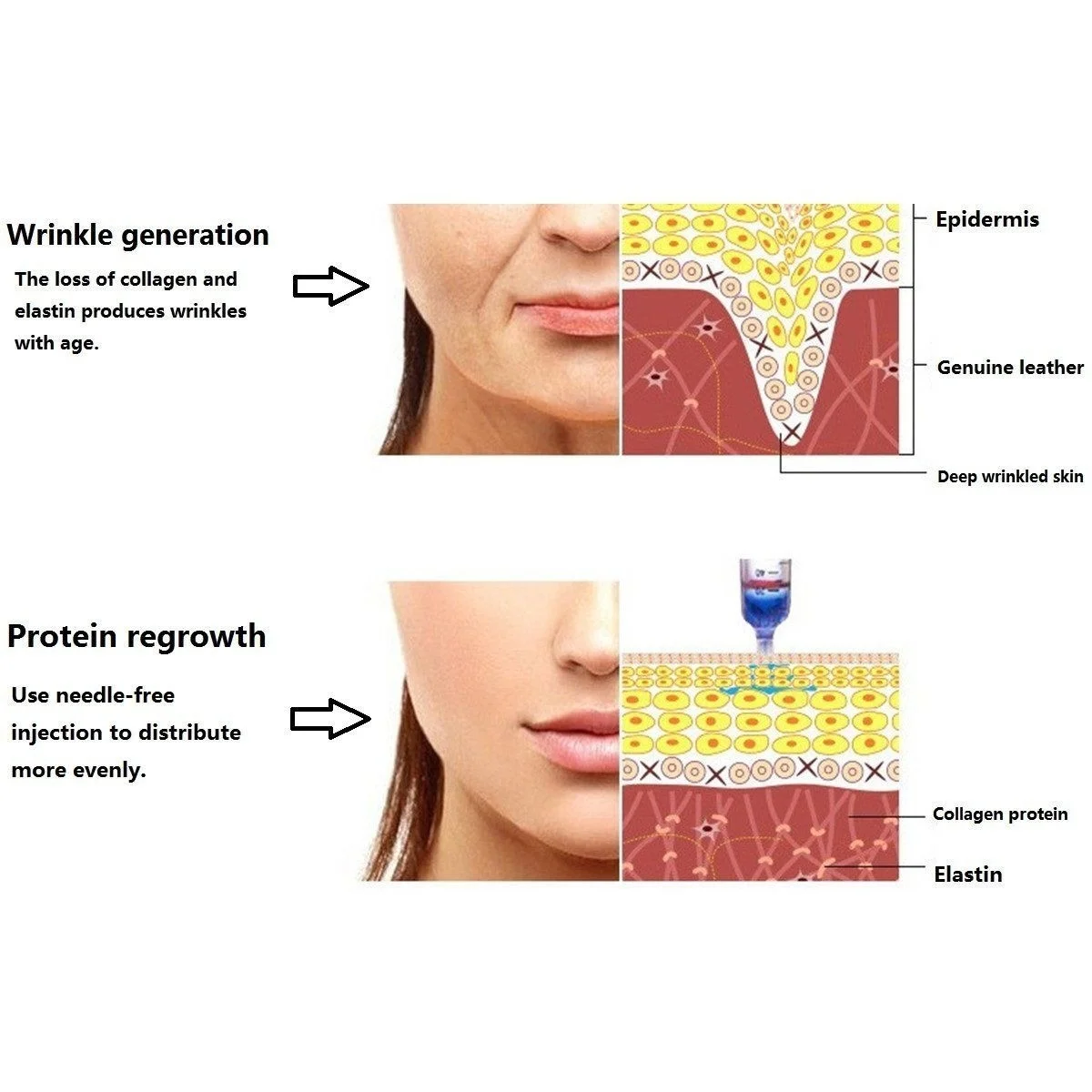 Неинвазивный небулайзер инжектор гиалуроновой кислоты ручки пистолет