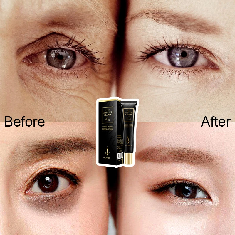 ROREC инъекции гиалуроновой кислоты для ухода за областью вокруг глаз крем