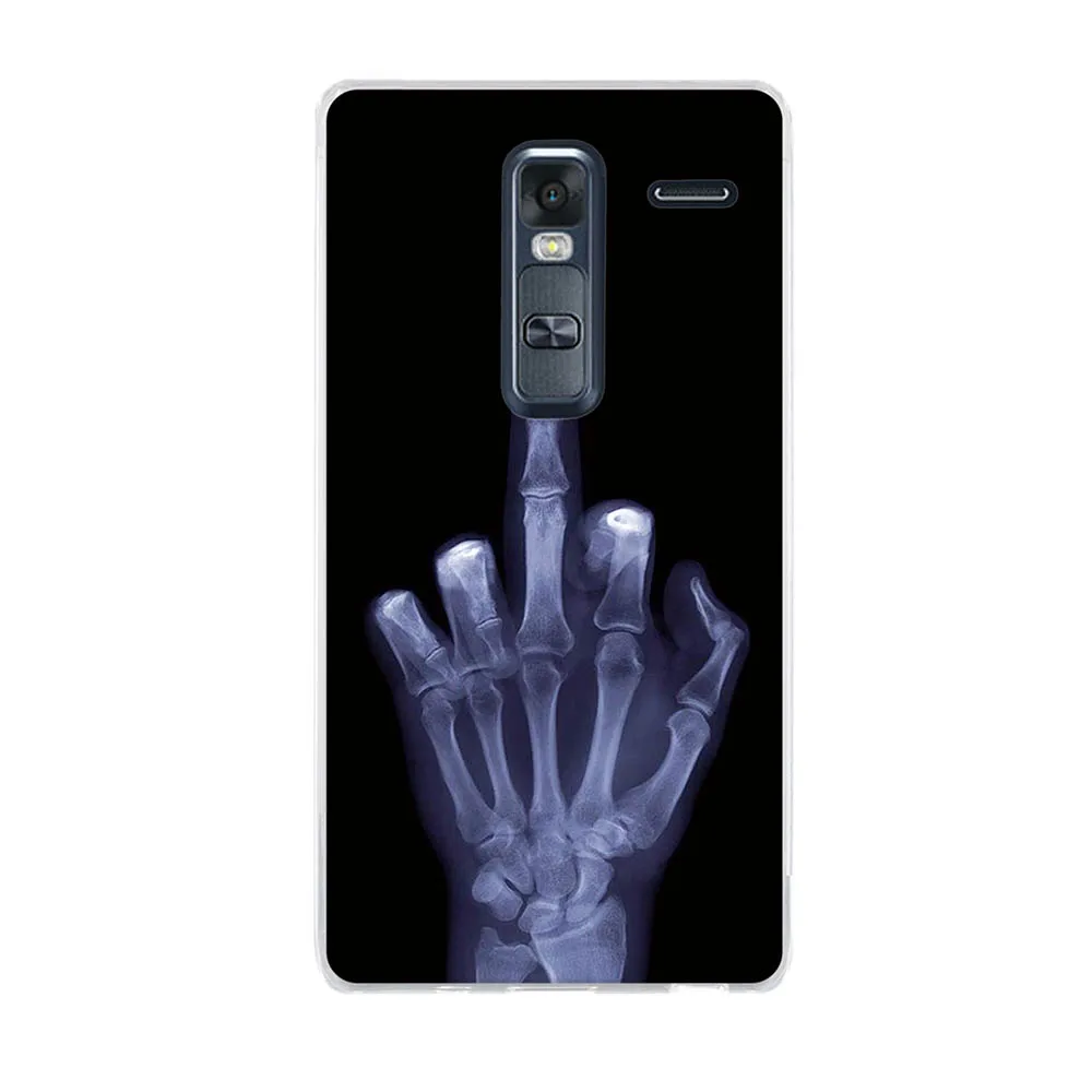 Чехол 5 0 дюйма для LG Zero H740 силиконовый чехол телефона защитный Class Ultra Slim TPU Frame Bumper