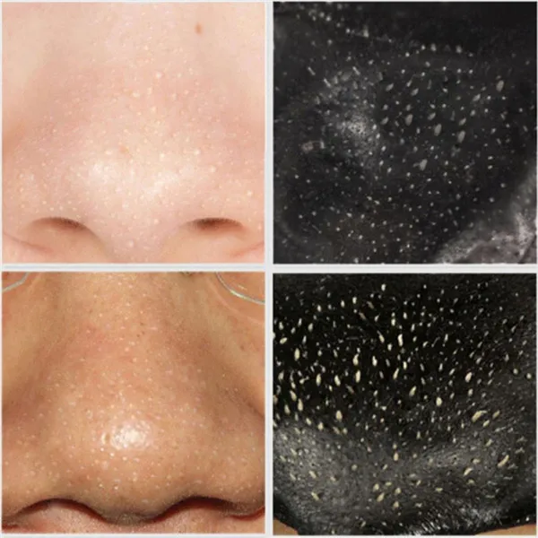 Средство для удаления черных точек черная грязь глубокое очищение Очищающая