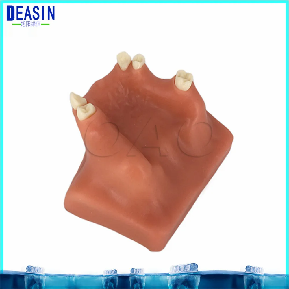 

Dental Orthodontics Typodont Teeth Model Half Metal Half Ceramic Brace bracket Typodont with Arch Wire