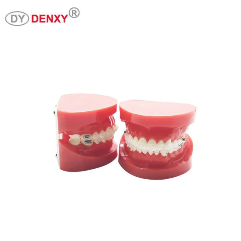 Denxy 1 шт. Стоматологическая модель с Ортодонтическая скобка исследование зубов Модель инструкция зубной ортодонтический керамический брекет Стоматологическая скоба