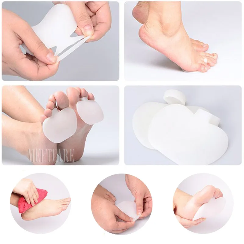 Фиксатор для обуви на высоком каблуке в форме яблока или груши|shoe brace|foot braceshoes for