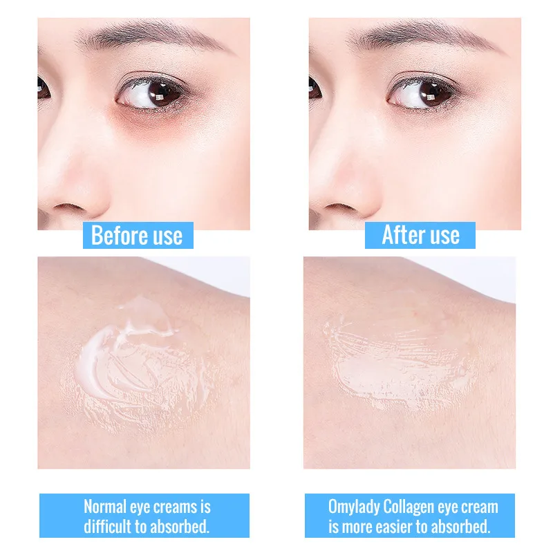 3PCS Eye Care Tools Cream Anti Wrinkle Anti-Aging Black Circle Moisturizing Puffiness Essence Herbal Reduce Bags | Красота и здоровье
