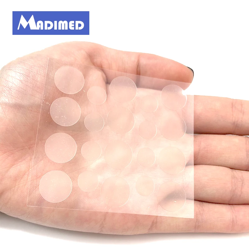 40 шт. Патчи от акне пятна блестящая наклейка черные точки|care|care face |