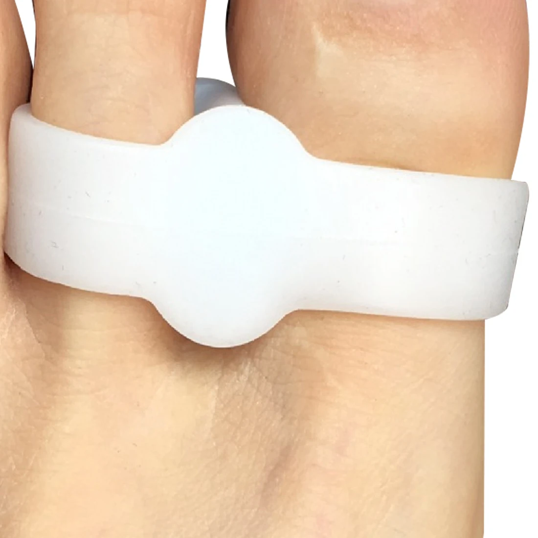 Выпрямители для пальцев ног сепаратор с 2 отверстиями шт. 1 пара корректор снятия