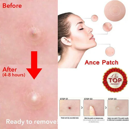 24 шт. патчи от акне и для удаления акне|Узкий пластырь| |