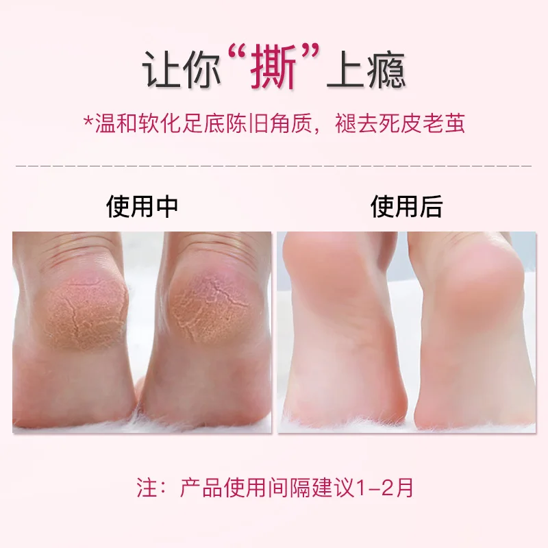 1 пара пилинг маска для ног отшелушивающие носки педикюр анти-трещины удаление