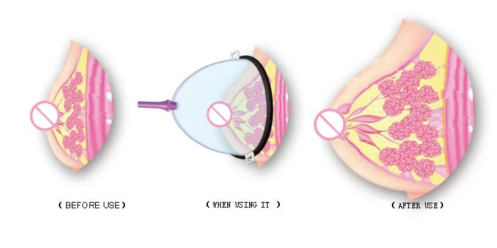 Грудь увеличить насос массажер груди Enhancer большой Размеры Электрический