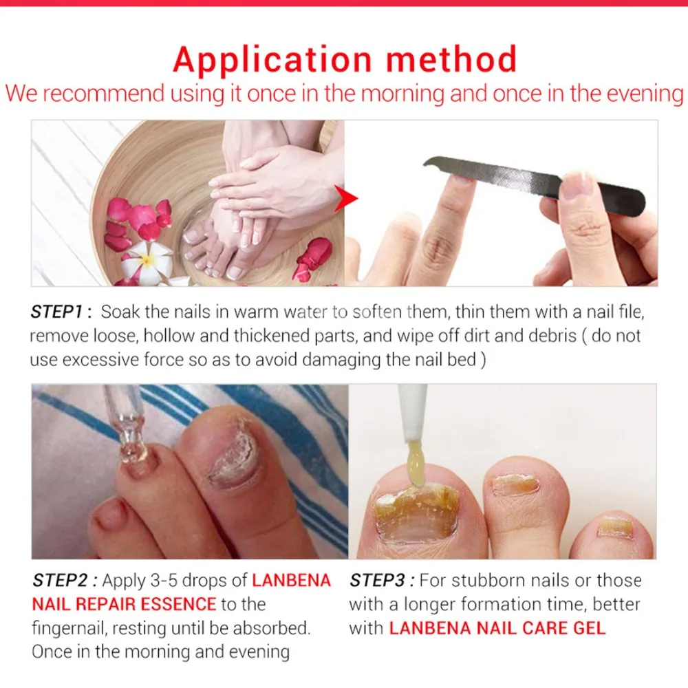 2 шт. высокое качество защита для ногтей крем ухода за кожей грибок лечение трав