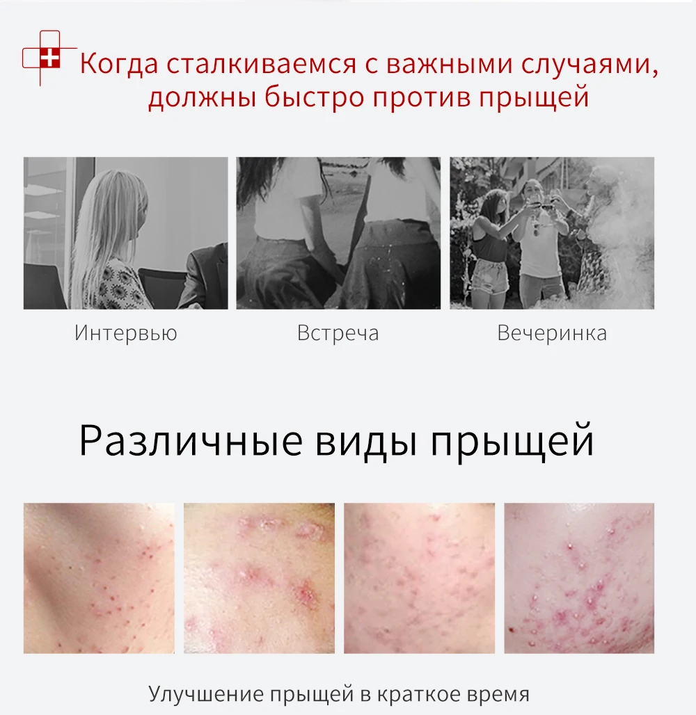 HANAJIRUSHI, лечение акне, Удаление прыщей, гель для лечения, чистый и прозрачный гель от угрей, контроль глубокого масла, против акне, увлажнение кожи, 25 г