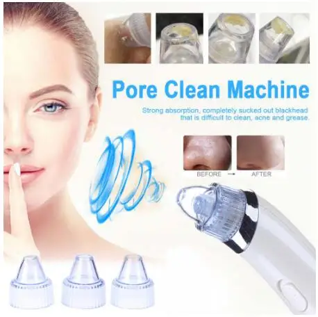 Горячие продукты Зарядное устройство USB Blackhead вакуумное устройство удаления Комедо всасывающее устройство с CE