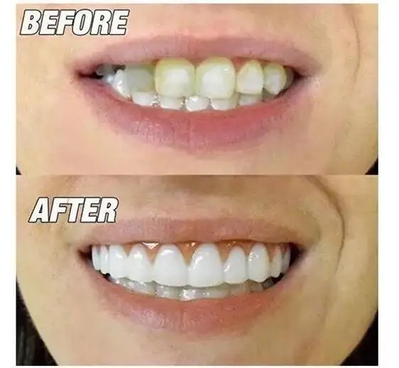 1 шт. верхний ряд белых зубьев набор силиконовых имитации на зубных протезов