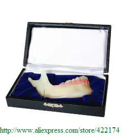 Бесплатная доставка Патологии Модель нижней челюсти зубные зубы анатомическая