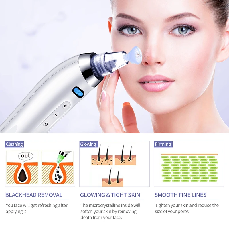 Инструмент для удаления угрей вакуумный инструмент черных точек ПОР уход за