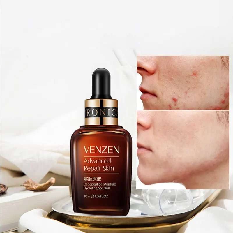 Средство для ухода за лицом VENZEN Niacinamide увлажняющий антивозрастной раствор