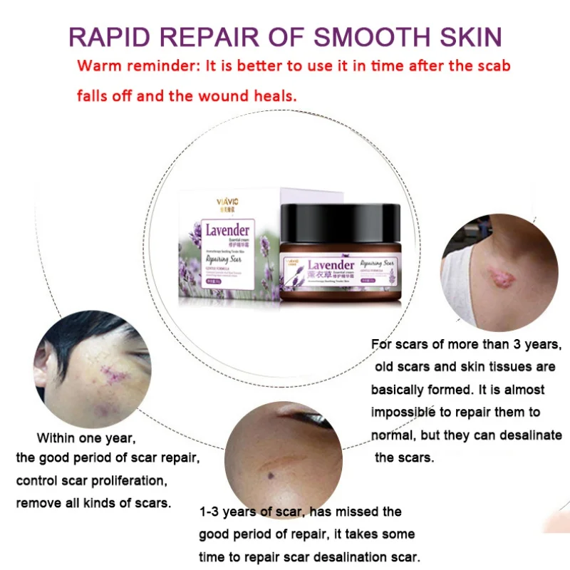 Lavender Hyaluronic Acid Scar Removal Cream Serum Repair Treatment Skin Care | Красота и здоровье