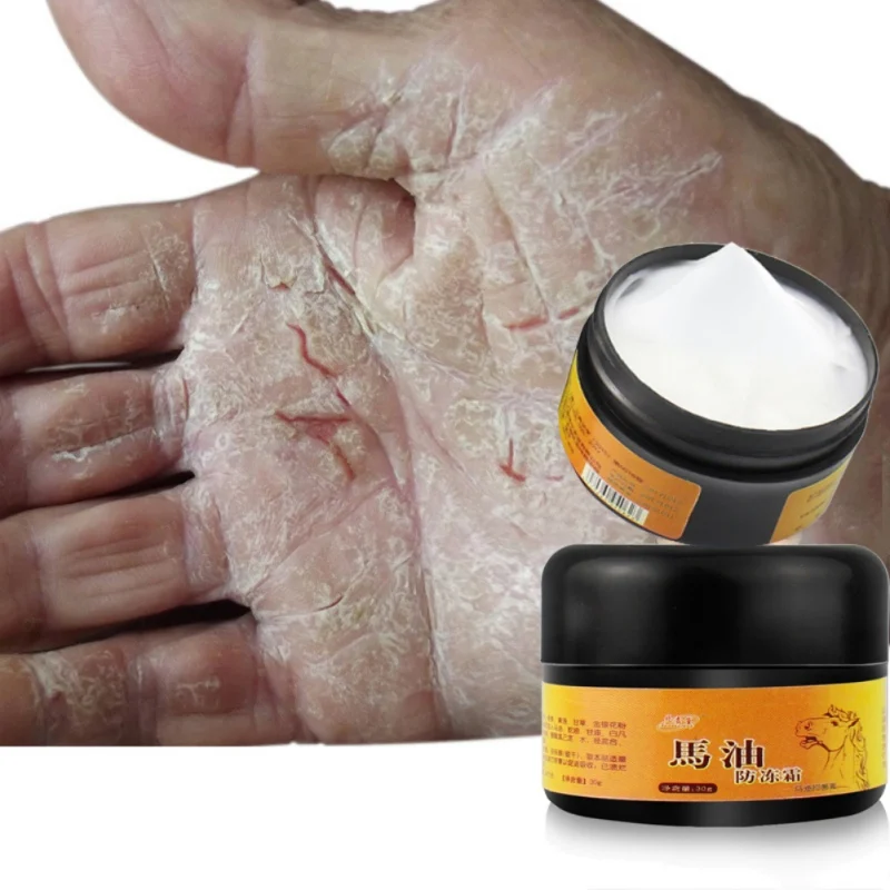 

30g Horse Oil Foot Cream Anti-Chapping Skin Repairing Moisturizer For Rough Dry And Cracked Chapped Feet Heel