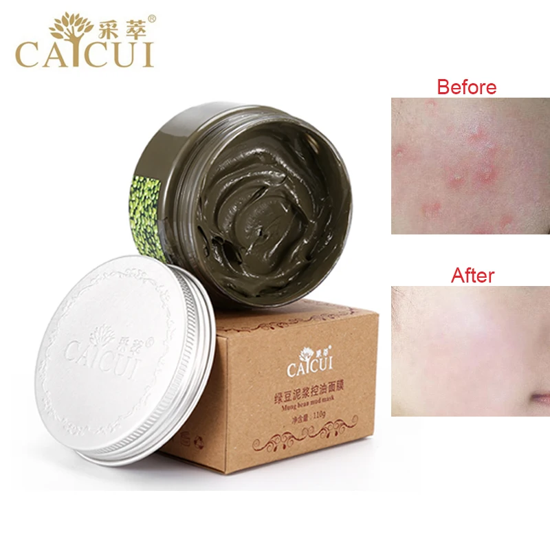 CAICUI Маш Маска Анти Акне Мыть Покраснение Гладкой Кожи Лица Care110g