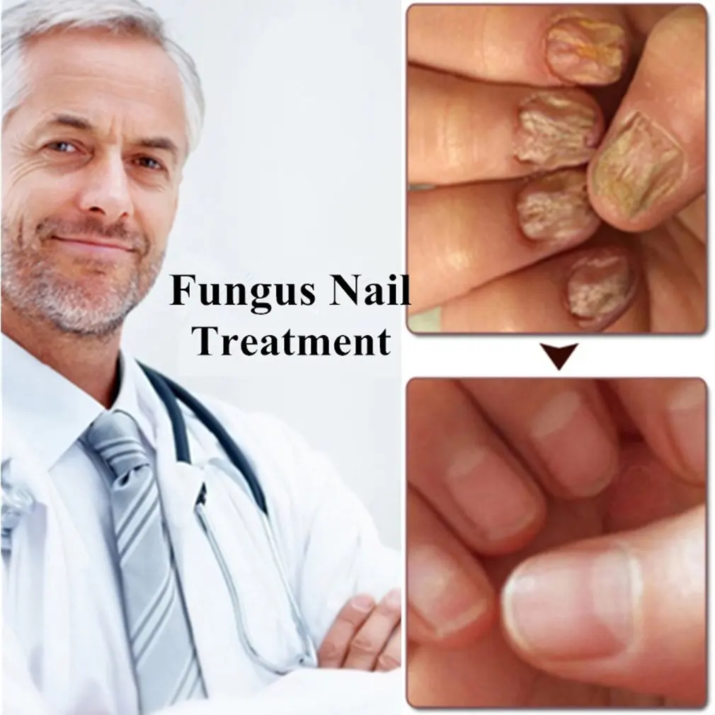 Лак для ногтей ухода за кожей пальцев на руках и ногах ногтями жидкое моющее