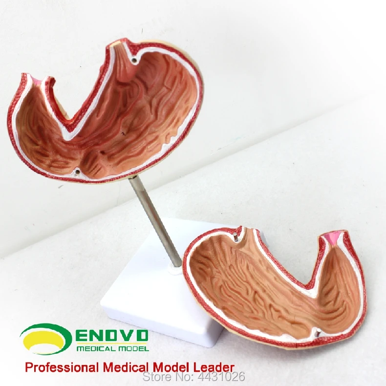 

ENOVO Gastric anatomic structure model of stomach model human digestive system organ medical anatomy model
