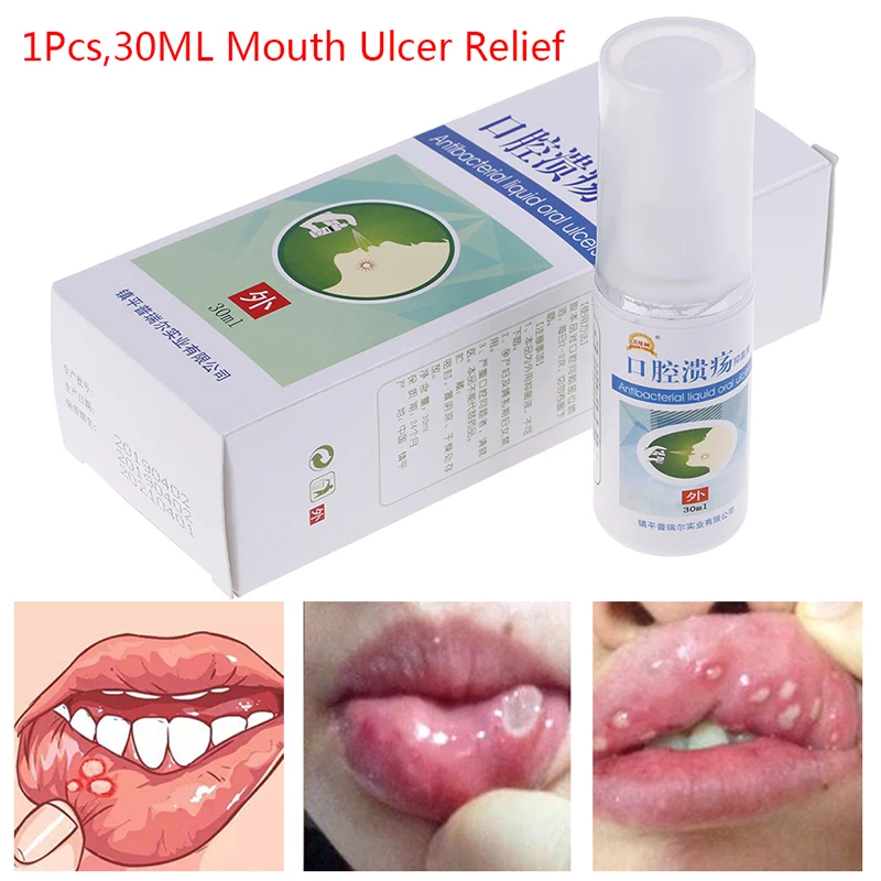 Лечение язва полости рта глотка Halitosis боль в горле прохладный свежий спрей