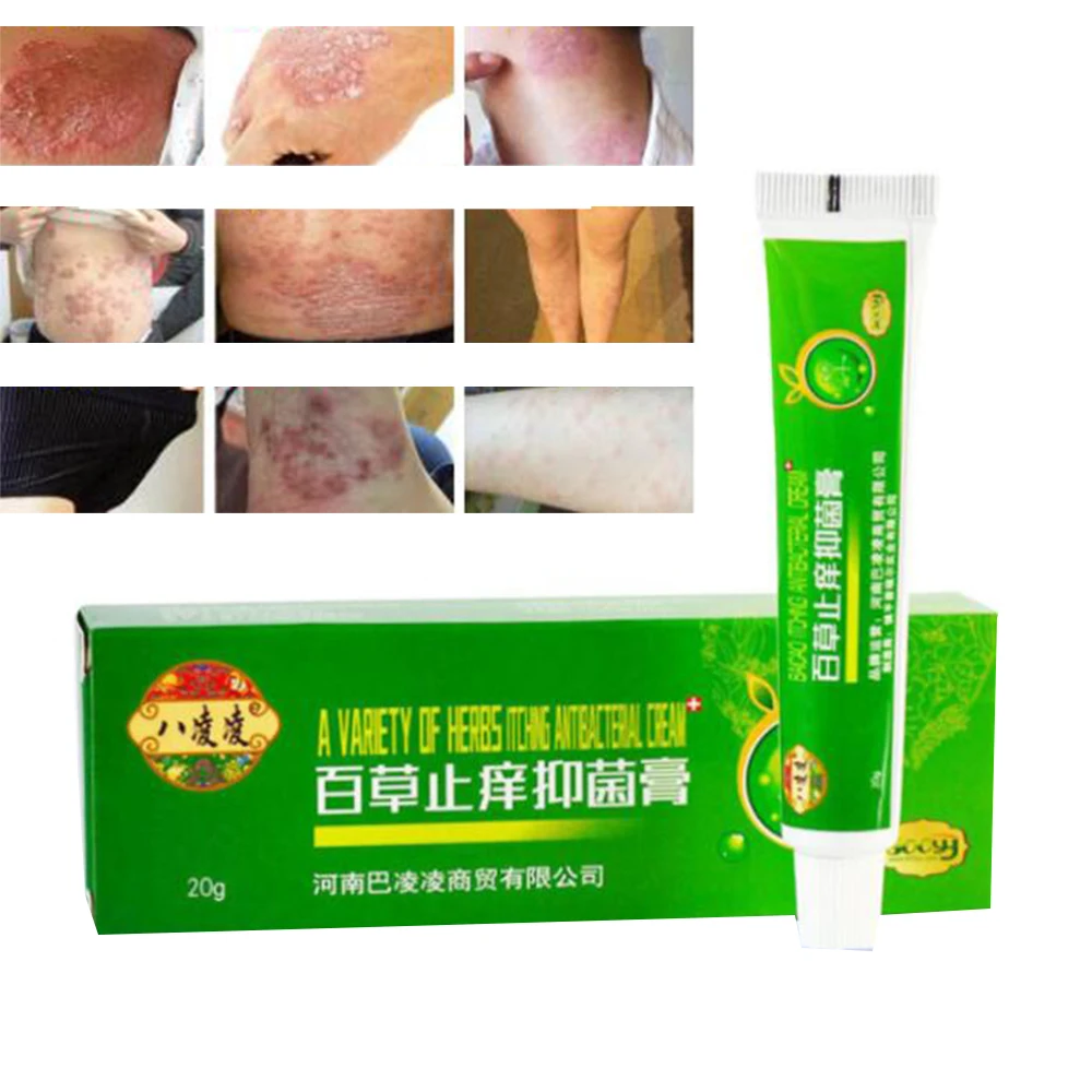 20 г натуральная китайская медицина Травяной Антибактериальный крем от псориаза