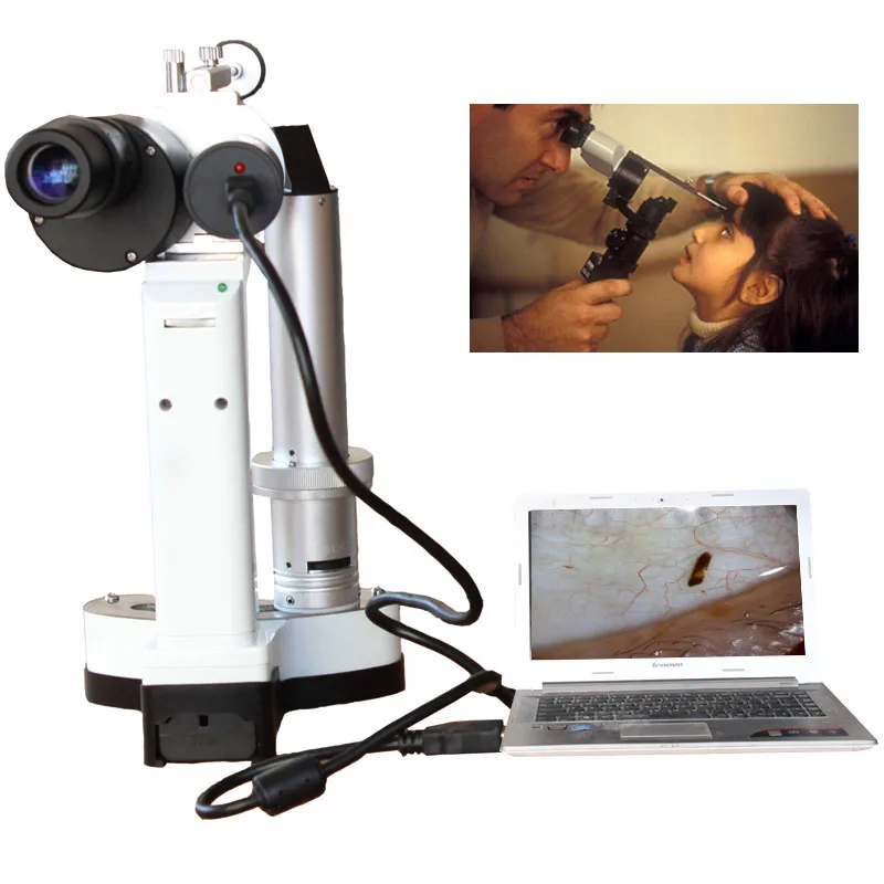 

LYL-S Portable Slit Lamp LED Bulb Portable Microscope for Pet hospital ophthalmology Camera Total 10x and 16x Magnification