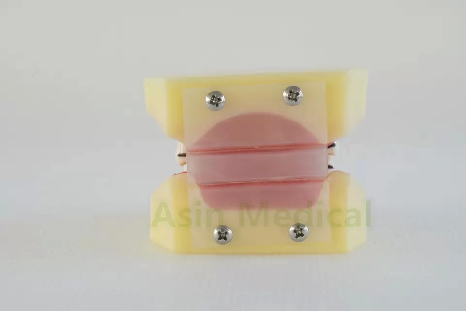 

Periodontosis model dental tooth teeth anatomical anatomy dentist model odontologia