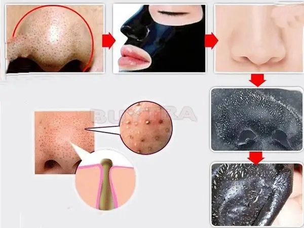 10 штук в наборе Уход за лицом черная маска накладки на нос от черных точек для