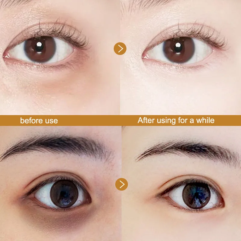 30 пар золотистого коллагена маска для глаз удаление темных кругов укрепляющая