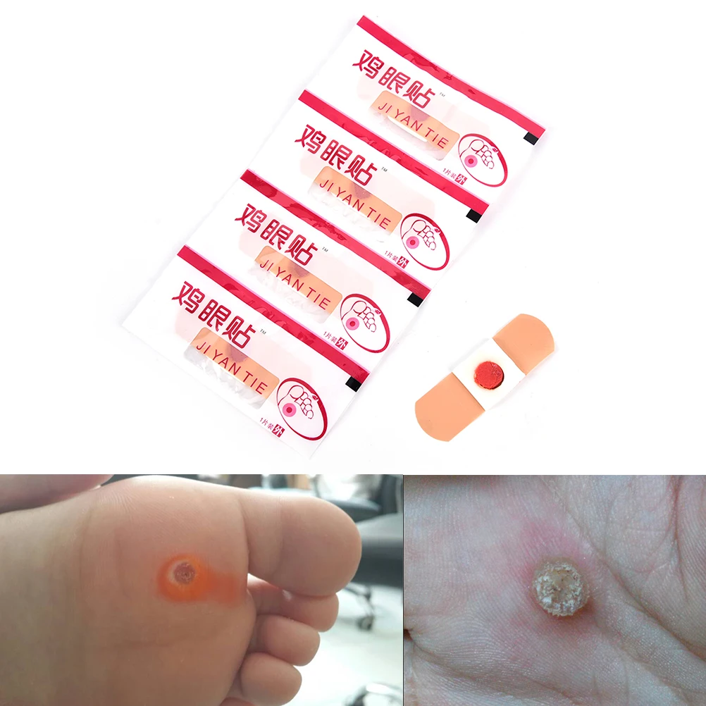 10 шт. удаление кукурузы для рук омертвевшей кожи Pedi Cure Care Китайская традиционная