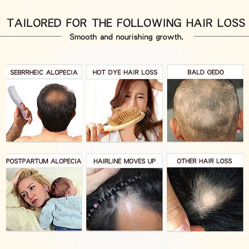 1 шт. марокканский травяной женьшень для ухода за волосами эссенция мужчин и